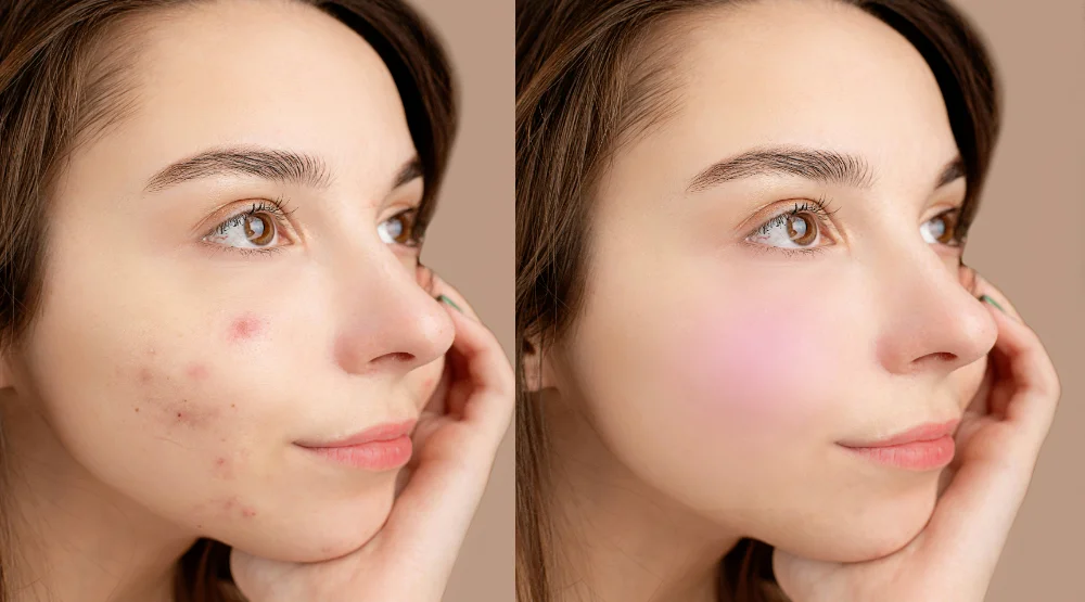 Cleaning/Retoching work on skin